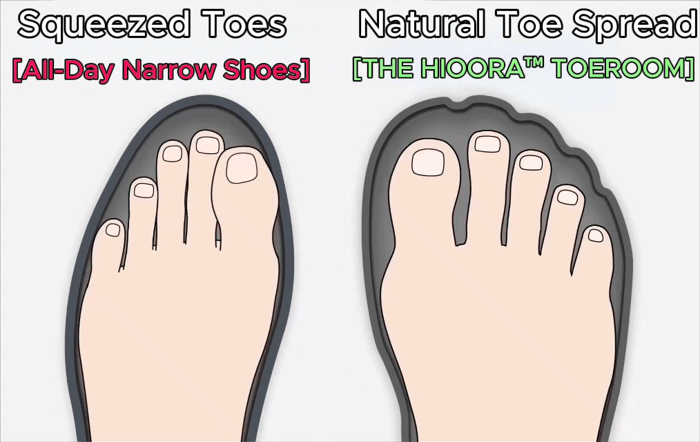 🦶 4-IN-1 FOOT RELIEF|TOE ROOM · ARCH SUPPORT · MASSAGE · CUSHIONING ✨ - detail 2